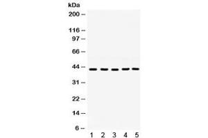 Western blot testing of 1) rat ovary, 2) rat testis, 3) mouse testis, 4) human 22RV1 and 5) human SKOV lysate with GNAQ antibody. (GNAQ Antikörper)