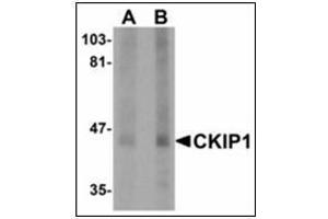 Western blot analysis of CKIP1 in human lung tissue lysate with CKIP1 antibody at (A) 1 and (B) 2 µg/ml. (PLEKHO1 Antikörper  (C-Term))