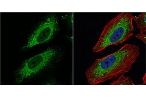 ICC/IF Image Pyruvate Dehydrogenase E1 alpha antibody detects Pyruvate Dehydrogenase E1 alpha protein at mitochondria by immunofluorescent analysis. (Pyruvate Dehydrogenase E1 alpha (Center) Antikörper)