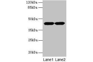 Western blot All lanes: ACTRT2 antibody at 6 μg/mL Lane 1: HepG2 whole cell lysate Lane 2: A431 whole cell lysate Secondary Goat polyclonal to rabbit IgG at 1/10000 dilution Predicted band size: 42 kDa Observed band size: 42 kDa (ACTRT2 Antikörper  (AA 1-376))