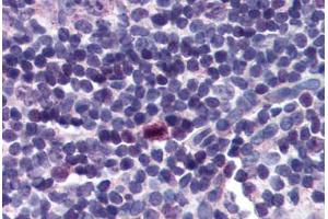 Human Tonsil (formalin-fixed, paraffin-embedded) stained with BIRC5 antibody ABIN214295 at 2. (Survivin Antikörper  (C-Term))