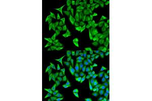 Immunofluorescence analysis of HeLa cells using PSMD9 antibody. (PSMD9 Antikörper  (AA 1-223))