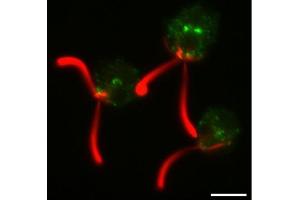Immunofluorescence (IF) image for anti-Clathrin Heavy Chain (CLTC) antibody (ABIN7477856)