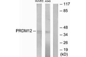 Western blot analysis of extracts from HuvEc/A549 cells, using PRDM12 Antibody. (PRDM12 Antikörper  (AA 191-240))