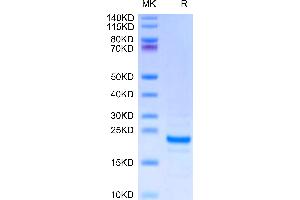 Midkine Protein (AA 23-140) (His tag)