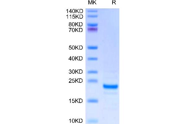 Midkine Protein (AA 23-140) (His tag)