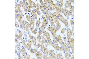 Immunohistochemistry of paraffin-embedded human liver injury using INADL antibody. (PATJ Antikörper)