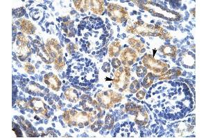P2RX7 antibody was used for immunohistochemistry at a concentration of 4-8 ug/ml to stain Epithelial cells of renal tubule (arrows) in Human Kidney.