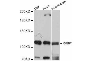 Western blot analysis of extracts of various cell lines, using RRBP1 antibody (ABIN6293720) at 1:3000 dilution. (RRBP1 Antikörper)