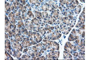 Immunohistochemical staining of paraffin-embedded Human Kidney tissue using anti-EIF2S1 mouse monoclonal antibody. (EIF2S1 Antikörper)