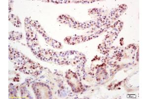 Formalin-fixed and paraffin embedded mouse intestine labeled with Rabbit Anti RNF36 Polyclonal Antibody, Unconjugated (ABIN872882) at 1:200 followed by conjugation to the secondary antibody and DAB staining (TRIM69 Antikörper  (AA 65-160))