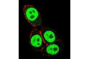 Confocal immunofluorescent analysis of SMAD3 Antibody  with Hela cell followed by Alexa Fluor 488-conjugated goat anti-rabbit lgG (green). (SMAD3 Antikörper  (Ser208))