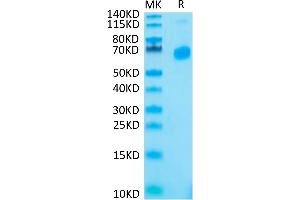 Human CD27 Ligand Trimer on Tris-Bis PAGE under reduced condition. (CD70 Protein (Trimer) (His tag))