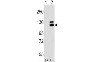 Western Blotting (WB) image for anti-PARG (PARG) antibody (ABIN3003113) (PARG Antikörper)
