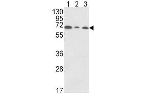Western Blotting (WB) image for anti-Polymeric Immunoglobulin Receptor (PIGR) antibody (ABIN3003801) (PIGR Antikörper)