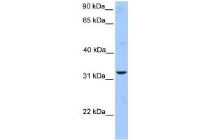 ATG5 antibody used at 1 ug/ml to detect target protein. (ATG5 Antikörper)