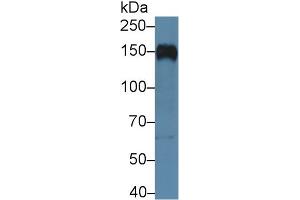 Western blot analysis of Human Raji cell lysate, using Human CR2 Antibody (5 µg/ml) and HRP-conjugated Goat Anti-Rabbit antibody ( (CD21 Antikörper  (AA 729-957))