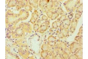 Immunohistochemistry of paraffin-embedded human pancreatic tissue using ABIN7174019 at dilution of 1:100 (FES Antikörper  (AA 120-420))
