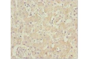 Immunohistochemistry of paraffin-embedded human liver tissue using ABIN7145187 at dilution of 1:100 (B9D1 Antikörper  (AA 1-130))