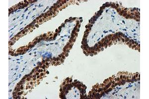 Image no. 10 for anti-F-Box Protein 21 (FBXO21) antibody (ABIN1498235)