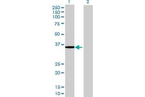 Western Blotting (WB) image for anti-UDP-Gal:betaGlcNAc beta 1,4- Galactosyltransferase, Polypeptide 4 (B4GALT4) (AA 1-344) antibody (ABIN522141)
