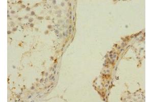 Immunohistochemistry of paraffin-embedded human testis tissue using ABIN7176393 at dilution of 1:100 (ZNF564 Antikörper  (AA 1-200))