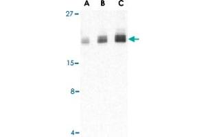 Western blot analysis of PTRH2 in Daudi cell lysate with PTRH2 polyclonal antibody  at (A) 1, (B) 2, and (C) 4 ug/mL . (PTRH2 Antikörper  (Internal Region))