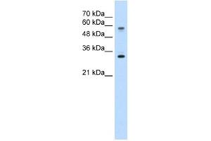 SLC22A1 antibody used at 5 ug/ml to detect target protein. (SLC22A1 Antikörper)