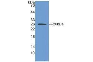 Detection of Recombinant CLIC1, Human using Polyclonal Antibody to Chloride Intracellular Channel Protein 1 (CLIC1) (CLIC1 Antikörper  (AA 79-241))