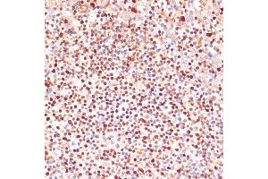 Immunohistochemistry of paraffin-embedded human tonsil using  antibody (ABIN3023072, ABIN3023073, ABIN3023074 and ABIN6219376) at dilution of 1:100 (40x lens).