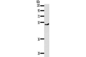 Gel: 10 % SDS-PAGE, Lysate: 40 μg, Lane: Mouse heart tissue, Primary antibody: ABIN7191971(PPARD Antibody) at dilution 1/500, Secondary antibody: Goat anti rabbit IgG at 1/8000 dilution, Exposure time: 30 seconds (PPARD Antikörper)