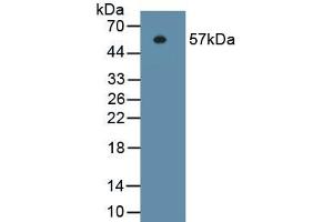 Detection of Recombinant ITGb1, Human using Monoclonal Antibody to Integrin Beta 1 (ITGb1) (ITGB1 Antikörper  (AA 140-383))