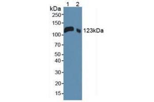 Western blot analysis of (1) Mouse Serum and (2) Mouse Placenta Tissue. (LIFR Antikörper  (AA 381-485))