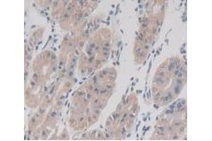 Detection of TMEM27 in Human Stomach Tissue using Monoclonal Antibody to Transmembrane Protein 27 (TMEM27) (TMEM27 Antikörper  (AA 17-137))