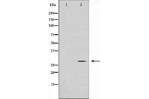 Western blot analysis on Jurkat cell lysate using GADD153 Antibody,The lane on the left is treated with the antigen-specific peptide. (DDIT3 Antikörper  (N-Term))