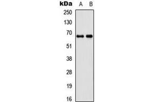 Western blot analysis of DDX55 expression in SHSY5Y (A), 293T (B) whole cell lysates. (DDX55 Antikörper  (Center))