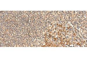 Immunohistochemistry of paraffin-embedded Human tonsil tissue using GALNT12 Polyclonal Antibody at dilution of 1:60(x200)