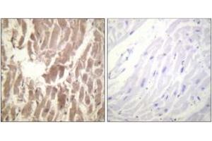 Immunohistochemistry analysis of paraffin-embedded human heart, using TNNI3 (Phospho-Ser43) Antibody. (TNNI3 Antikörper  (pSer43))