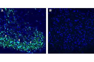 Expression of C3aR1 in rat spinal cord. (C3AR1 Antikörper  (Extracellular))