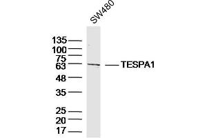 SW480 lysates probed with TESPA1 Polyclonal Antibody, Unconjugated  at 1:300 dilution and 4˚C overnight incubation. (TESPA1 Antikörper  (AA 231-330))