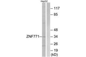 Western blot analysis of extracts from HepG2 cells, using ZNF771 Antibody. (ZNF771 Antikörper  (AA 161-210))