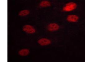 ABIN6267629 staining HeLa cells by ICC/IF. (NFATC3 Antikörper  (pSer165))