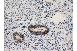 Image no. 10 for anti-Nonhomologous End-Joining Factor 1 (NHEJ1) antibody (ABIN1499729) (NHEJ1 Antikörper)