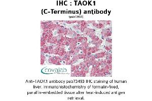 Image no. 2 for anti-TAO Kinase 1 (TAOK1) (C-Term) antibody (ABIN1739898) (TAO Kinase 1 (TAOK1) (C-Term) Antikörper)