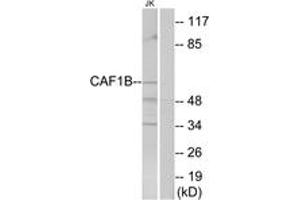 Western blot analysis of extracts from Jurkat cells, using CAF1B Antibody. (CHAF1A Antikörper  (AA 71-120))