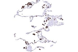 Normal lung showing strong Napsin A immunostaining of pneumocytes and alveolar macrophages (Rekombinanter NAPSA Antikörper  (AA 189-299))