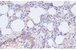Immunohistochemistry of paraffin-embedded Rat lung using VASP Polyclonal Antibody at dilution of 1:100 (40x lens). (VASP Antikörper)