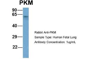 Host: Rabbit  Target Name: PKM  Sample Tissue: Human Fetal Lung  Antibody Dilution: 1.