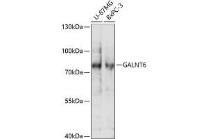 Western blot analysis of extracts of various cell lines, using G antibody (ABIN7271209) at 1:1000 dilution. (GALNT6 Antikörper  (AA 30-140))