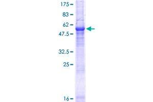 PEX26 Protein (AA 1-305) (GST tag)